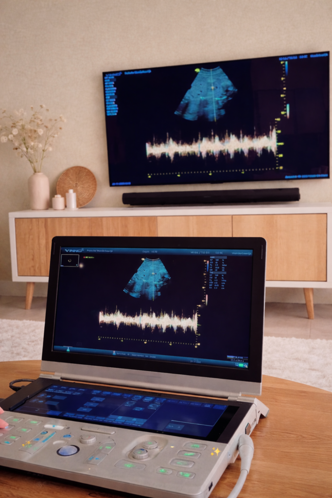 Het echoapparaat gekoppeld aan tv in een huiselijke setting. 