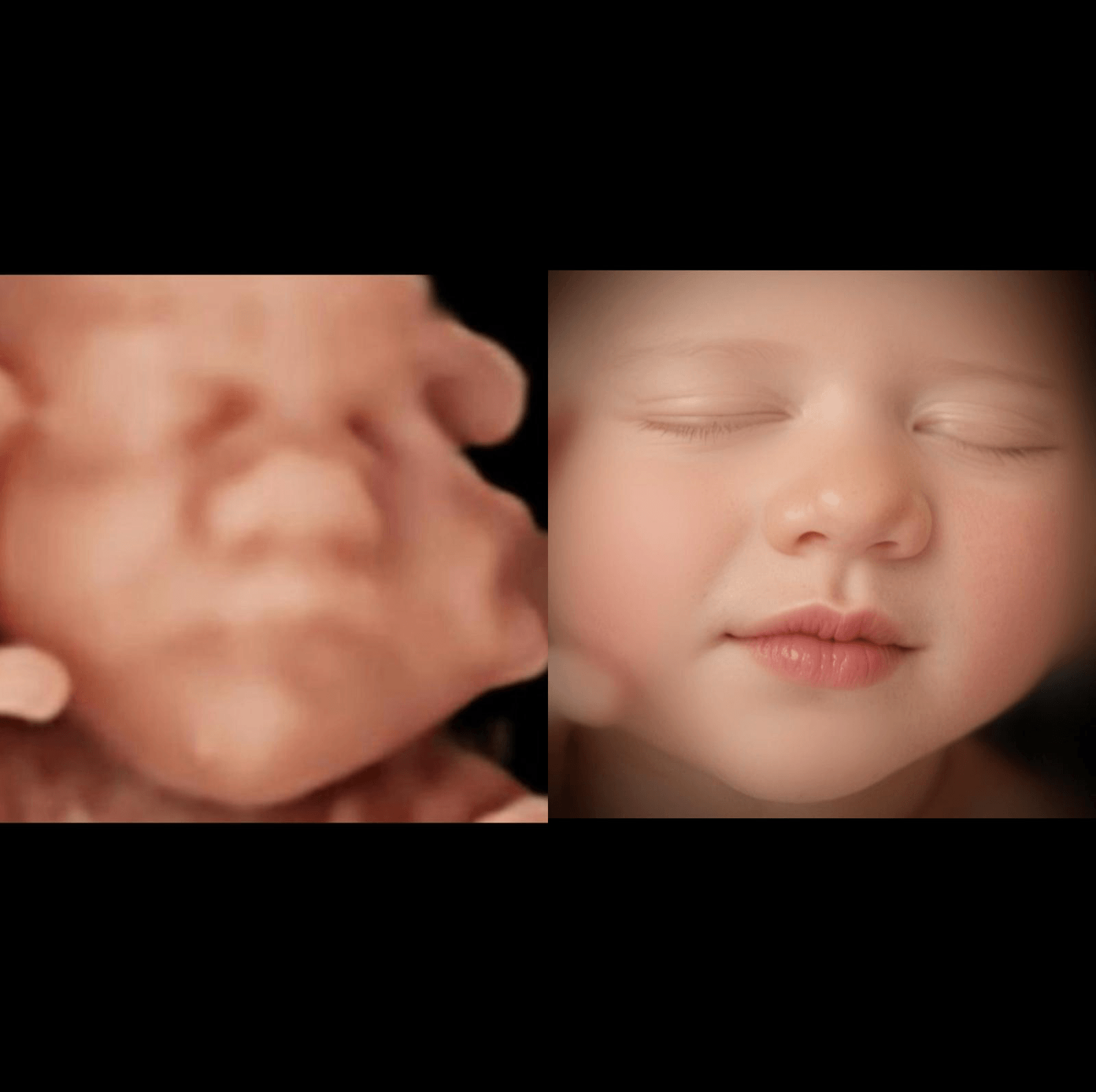 Vergelijking van een 3D-echobeeld met een realistische 6D-afbeelding